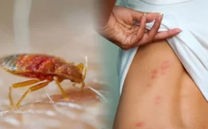 Rệp giường: Định nghĩa và cách diệt siêu an toàn và hiệu quả tại nhà 1 1 1