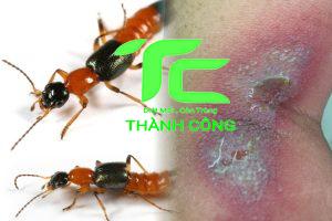 Tác hại của kiến ba khoang và cách xử lý hiệu quả 25 Tác hại của kiến ba khoang và cách xử lý hiệu quả